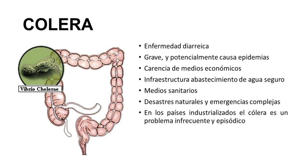 La llegada del cólera a A Coruña