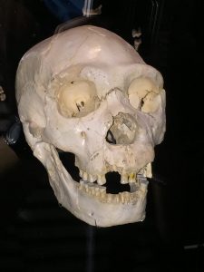 Cráneo Miguelón